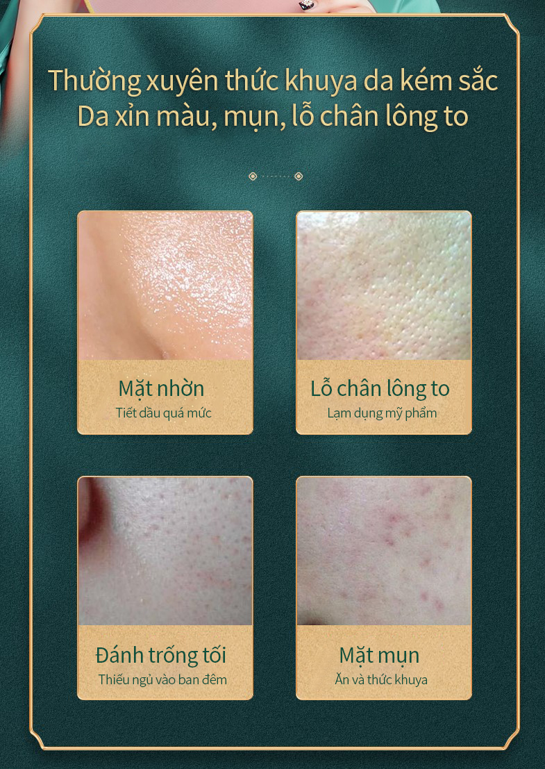 V7 Toning Cream Làm trắng, dưỡng ẩm, giảm nếp nhăn, giúp da mịn ...