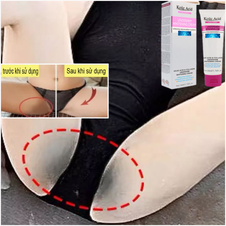 Kem xoá thâm mông, kem làm trắng da vùng nách，làm hồng mịn màng vùng kín, loại bỏ thâm đầu ti, kem làm trắng hồng vùng kín, làm trắng mông, cổ, vùng đùi và bắp chân.