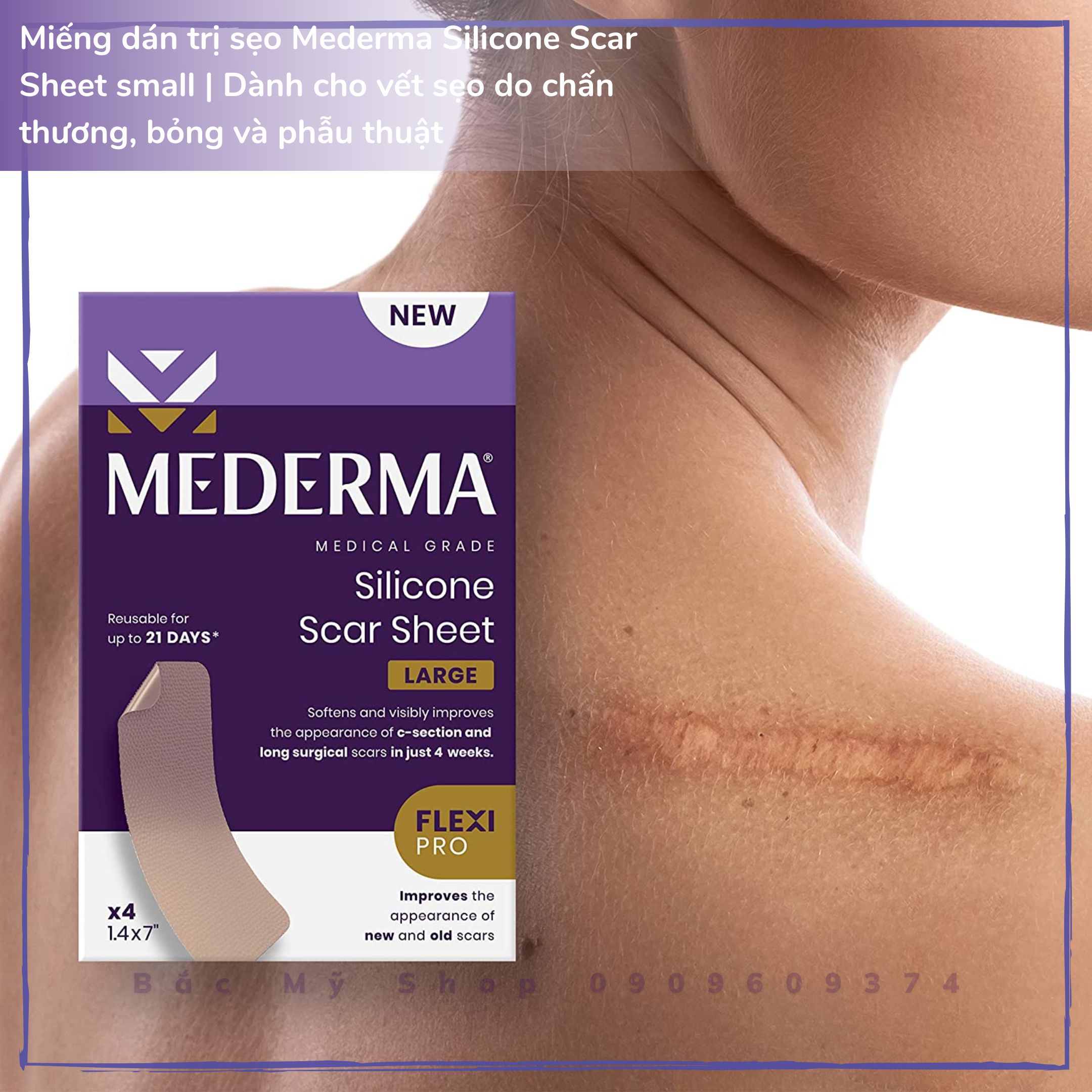 Miếng dán mờ sẹo Mederma Medical Grade Silicone Small Scar Sheet Dành cho