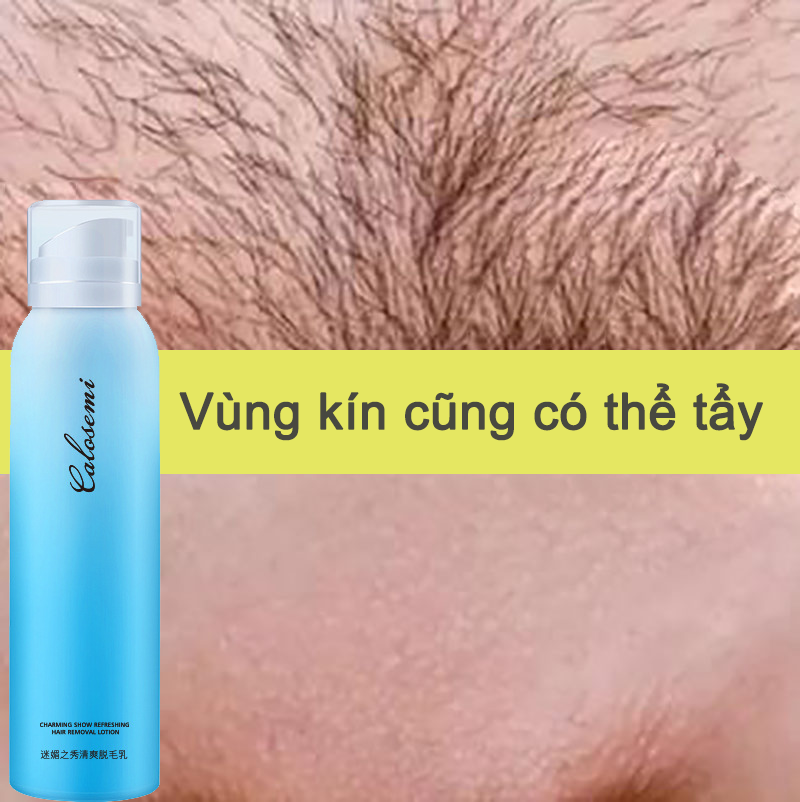 Kem Triệt Lông Dạng Xịt triệt lông an toàn tại nhà, triệt lông vùng kín, tẩy lông tay, chân, nách, bikini - triệt lông an toàn chỉ sau 8 phút, dùng được cho da nhạy cảm, an toàn, không gây kích ứng, Xịt tẩy lông,Tẩy lông nhanh chóng