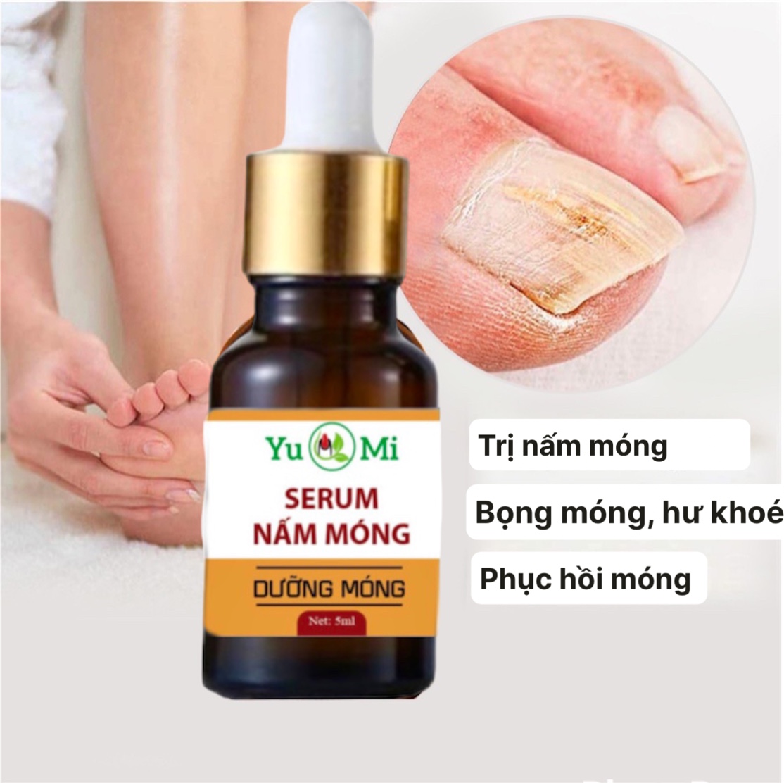 Tinh chất đánh bay nấm móng tay chân,viêm móng ,hư khóe,bọng móng,làm cứng móng nhanh dài