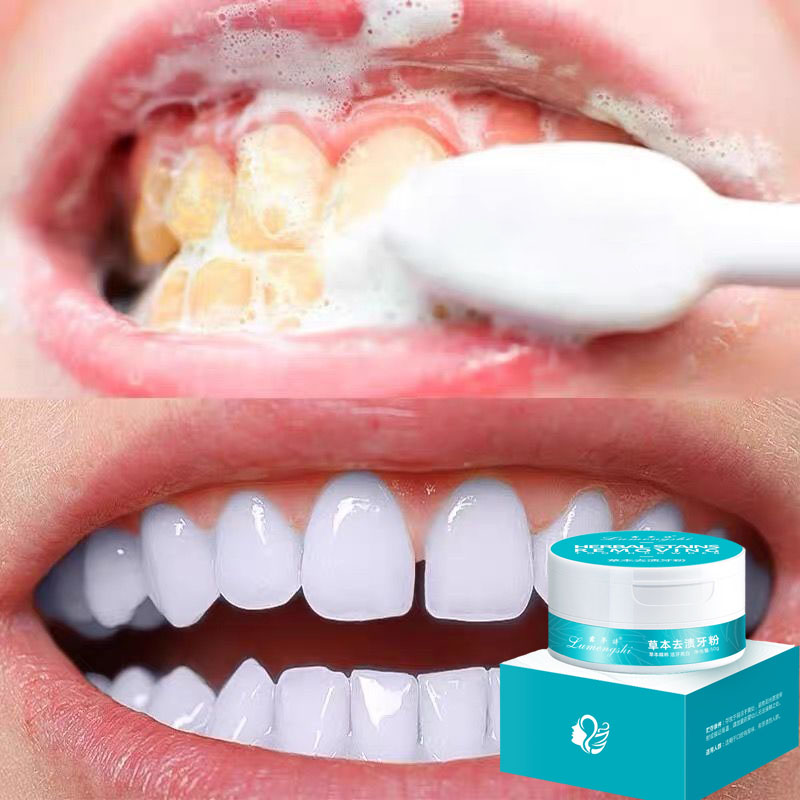 Tinh chất làm trắng răng ,bột trắng răng nhanh chóng