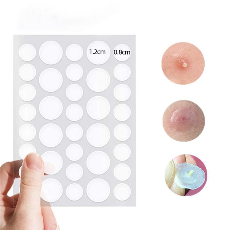 Set 36 miếng dán mụn acne plasters, miếng dán che mụn làm xẹp che phủ mụn
