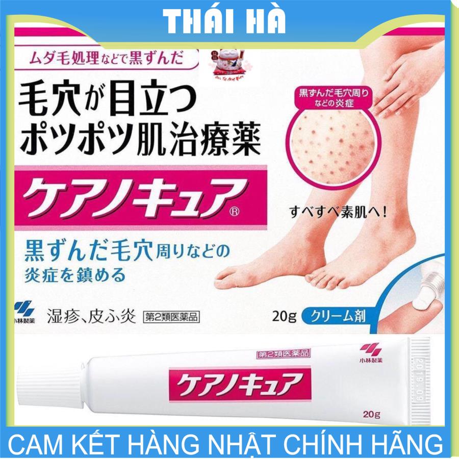 Kem Viêm Nang Lông Kobayashi 20g Nội Địa Nhật Bản