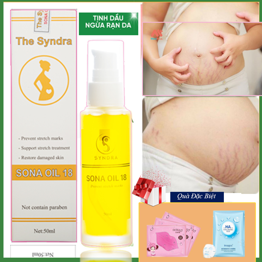 Dầu rạn da bầu sona oil , kem rạn da cho mẹ bầu sau sinh rạng do tăng cân tuổi dậy thì an toàn cho do nhạy cảm
