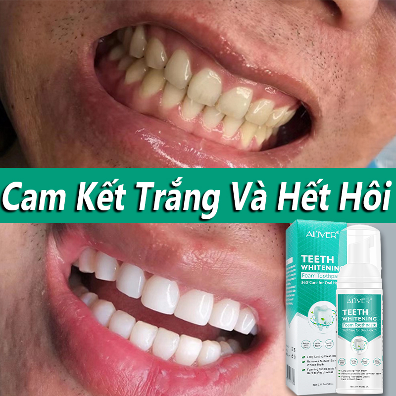 Kem đánh răng làm trắng răng Khử hôi miệng tẩy trắng răng Giảm sâu răng kem đánh rặng,loại bỏ mảng bám vết bẩn giảm ê buốt răng 60 ml