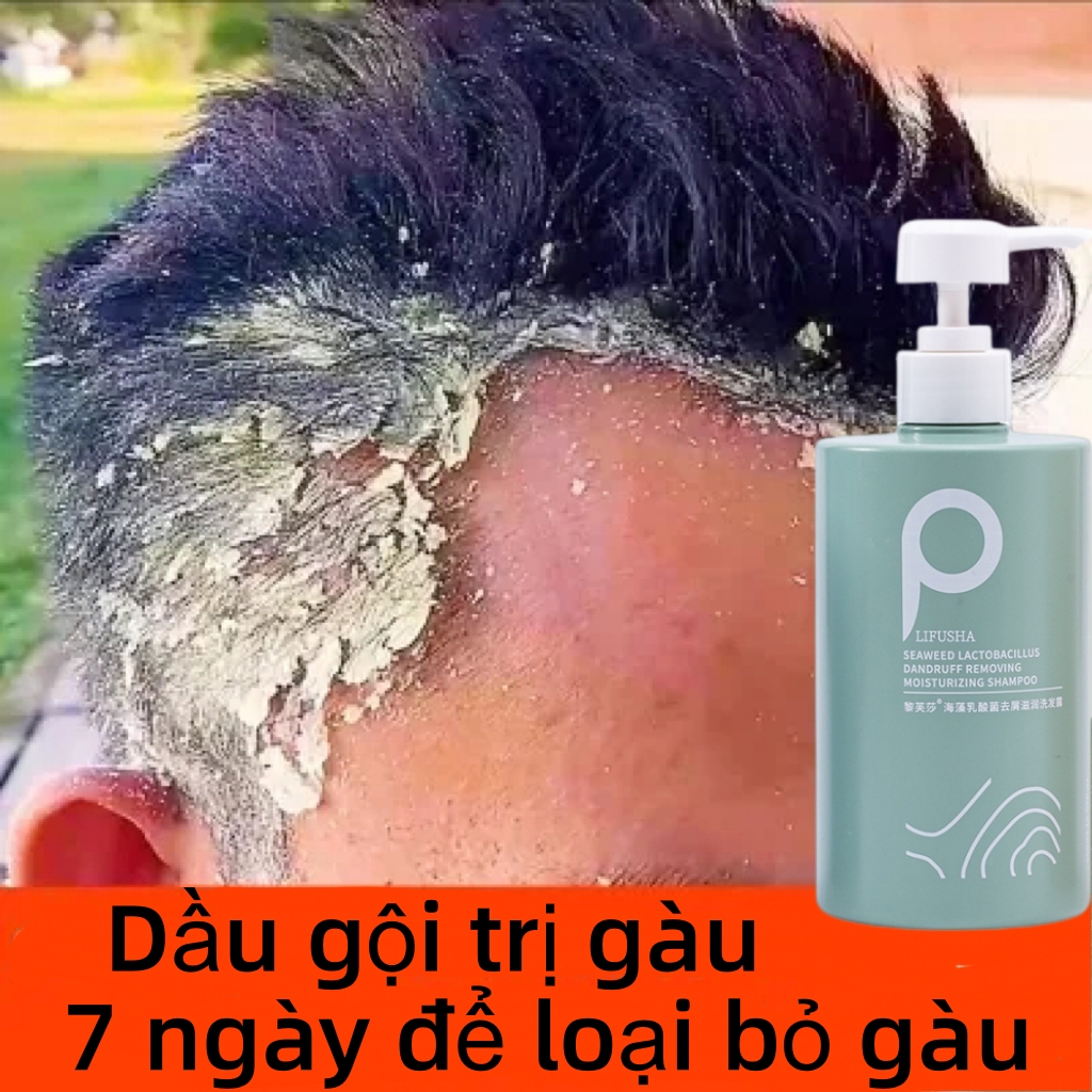  Dầu gội đầu Dầu gội muối biển dầu gội gàu dầu gội mượt tóc 500ml Làm mới kiểm soát dầu loại bỏ ngứa ngáy Dầu gội loại bỏ mạt dầu gội giảm ngứa 500ml làm sạch sâu da đầu Làm mới kiểm soát dầu loại bỏ ngứa ngáy Nhẹ nhàng và không gây kích ứng 