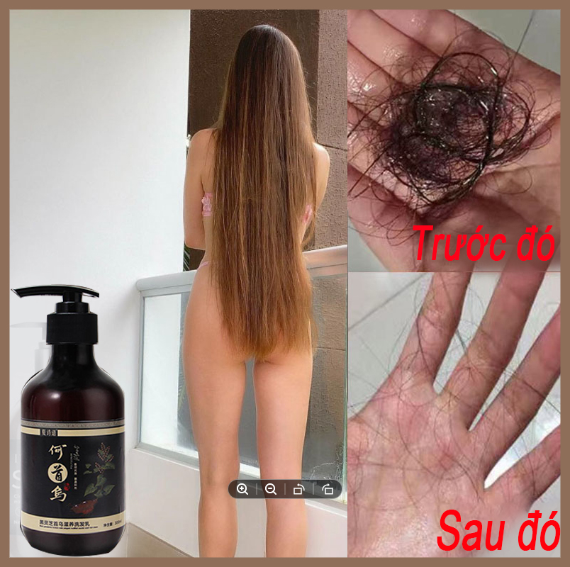 Dầu gội rụng tóc Dầu gội tẩy tế bào chết dầu gội thảo dược 200ML Kích thích tăng trưởng tóc, giảm gàu, giảm tóc bạc sớm, dầu gội Hà Thủ Ô chăm sóc tóc hiệu quả