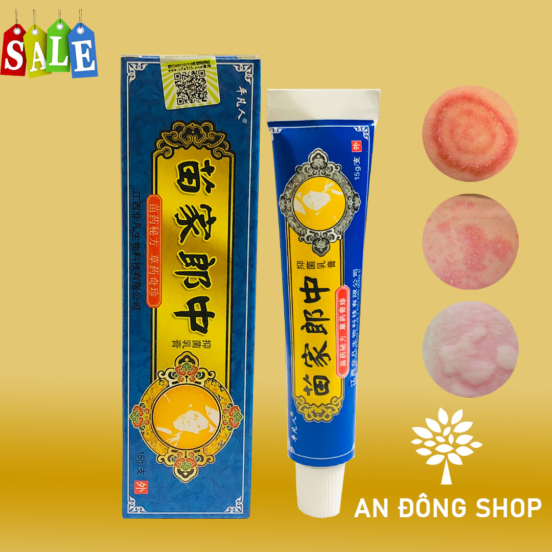 Kem bôi da liễu, hắc lào, nấm móng tay, nấm đầu, á sừng lâu năm nứt gót chân tay