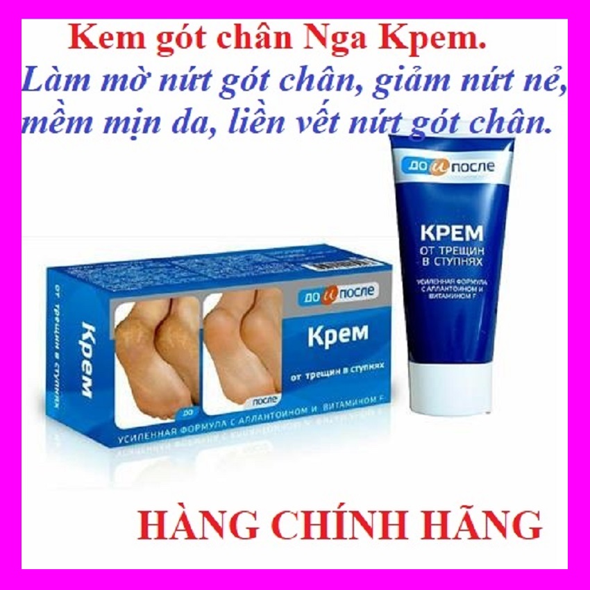 Kem nứt gót chân Kpem 50ml, kem dưỡng da chân, mềm mại, hồng hào gót chân - OAISEA