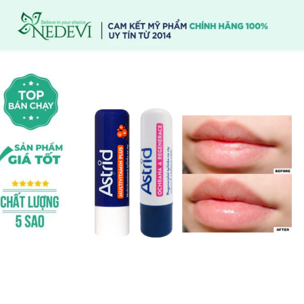 Son Dưỡng Môi Mỡ Hươu Astrid Fullsize 4.7g Nedevi