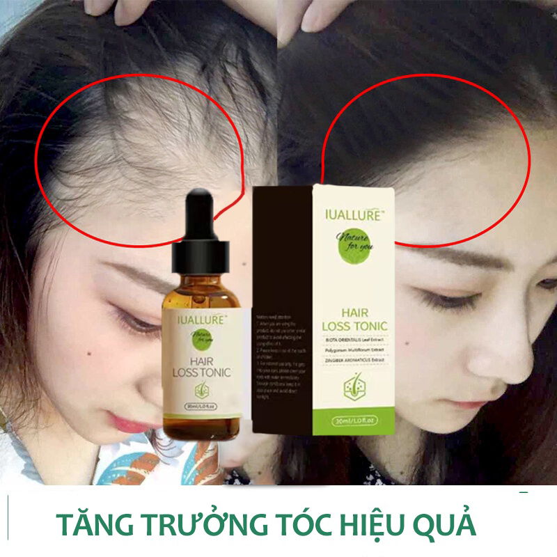 Tinh dầu tăng trưởngTinh Dầu Chống Rụng Tóc 30ml Tinh dầu mạnh mẽ Chống Rụng Tóc Ngừa rụng tóc ngăn ngừa gàu Tinh Chất Kích Thích Mọc Tóc kích thích mọc tóc ngăn rụng tóc suôn mượt