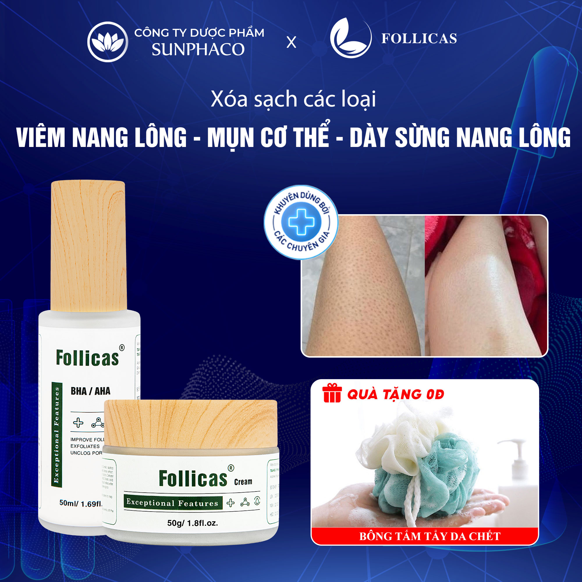 Bộ kem xịt viêm nang lông, mụn lưng follicas giảm mụn lưng, viêm lỗ chân lông, mờ thâm giúp sáng da mịn màng