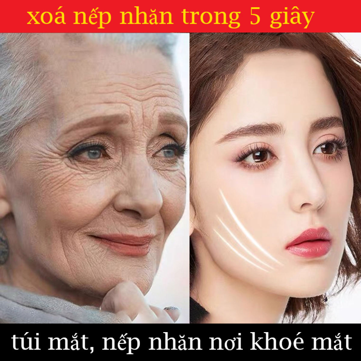Kem chống nếp nhăn mạnh mẽ, nước tinh chất phần mắt, kem làm đi nếp nhăn trong 5 giây ,loại bỏ các nếp nhăn và vết thâm trên khuôn mặt , làm săn chắc da, làm trắng da và dưỡng ẩm, chống lão hoá