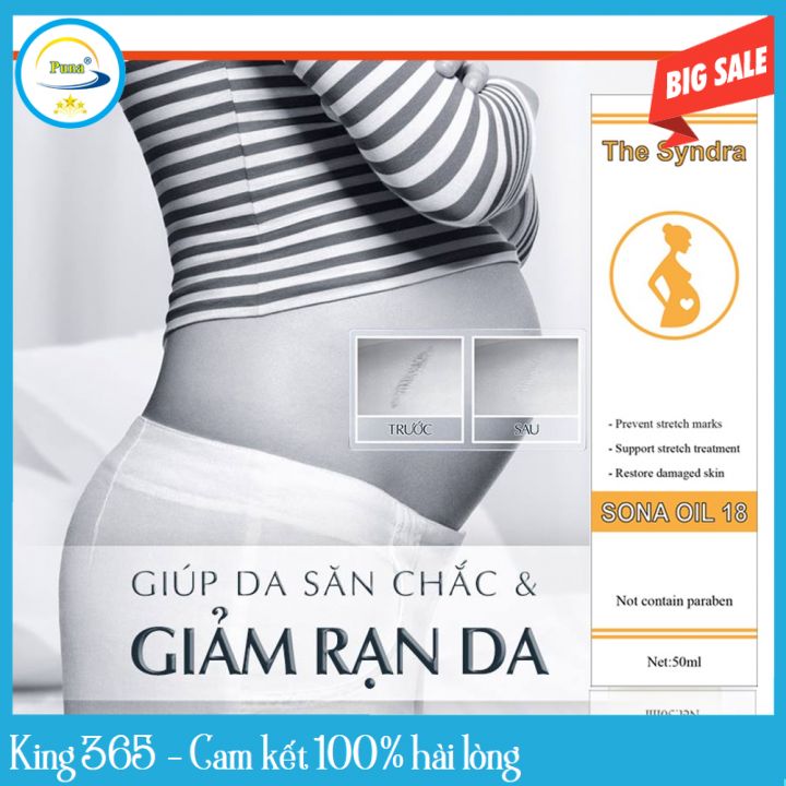 Dầu rạn da cho mẹ bầu giúp dưỡng ẩm cho da khô chống nứt nẻ rạn da, kem rạn da cho bà bầu giảm rạn da vùng bụng mông đùi sau sinh do tăng cân nhanh sona oil 18