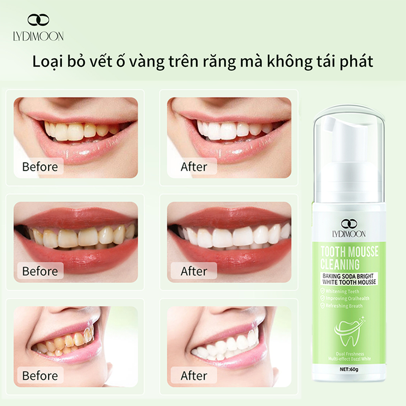 Toothpaste mousse teeth whitening teeth ventilator remove dirt stains