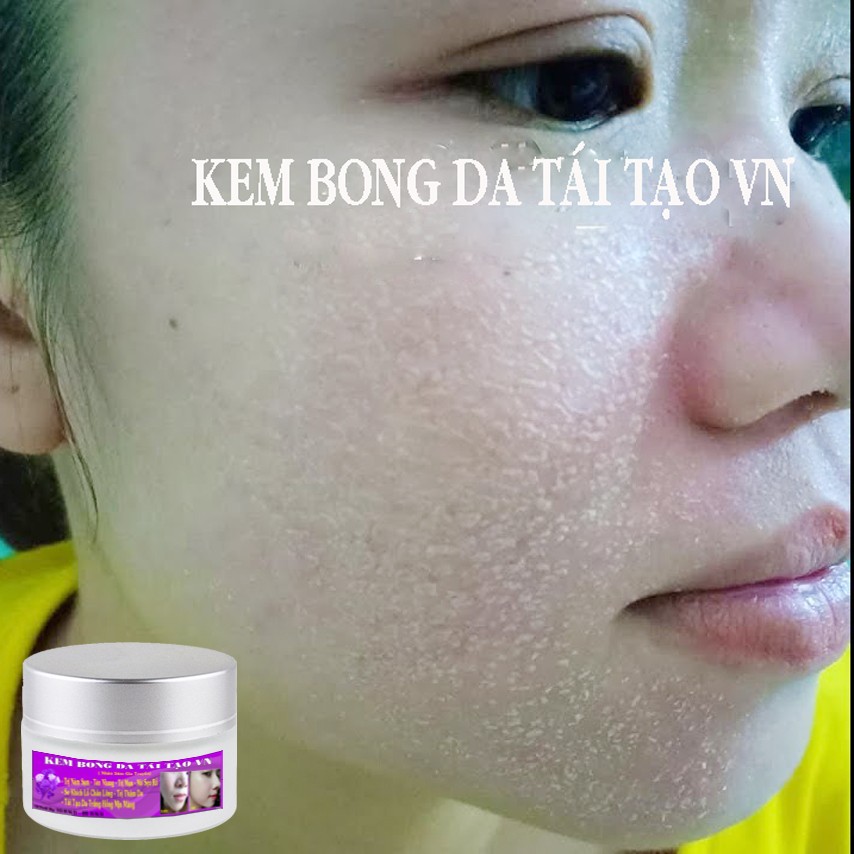 Bộ kem vỗ bong da tái tạo vn + kem dưỡng trắng xóa nám sạm