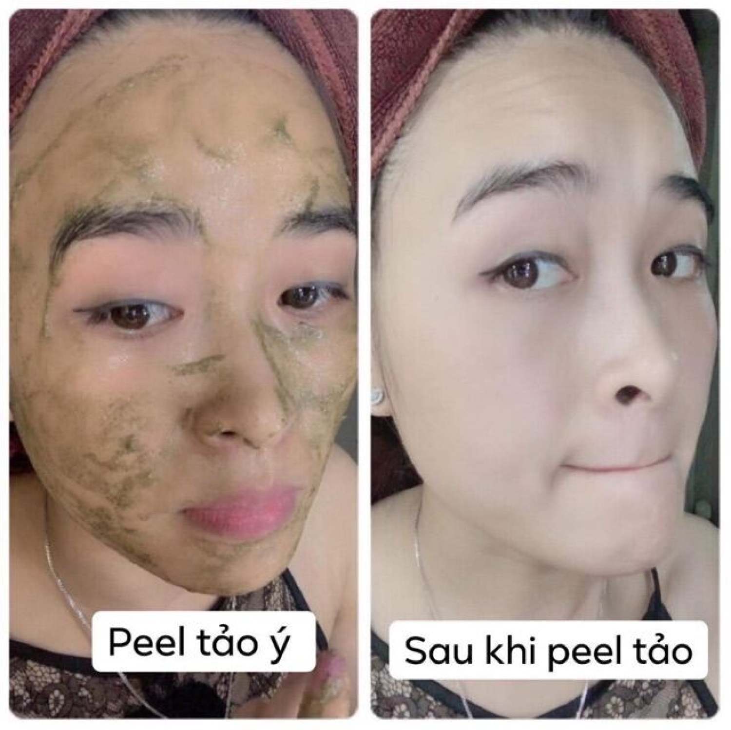 1 bộ - peel da vi tảo 7 ngày đẹp - peel da vi tảo sinh học le'peau