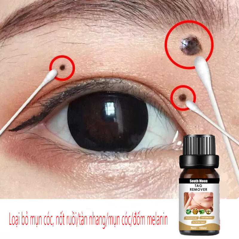 Kem tẩy nốt ruồi, loại bỏ mụn cơm mụn cóc, nốt ruồi trên mặt/ tàn nhang/ mụn cơm/ đốm đen hắc tố, không để lại sẹo.