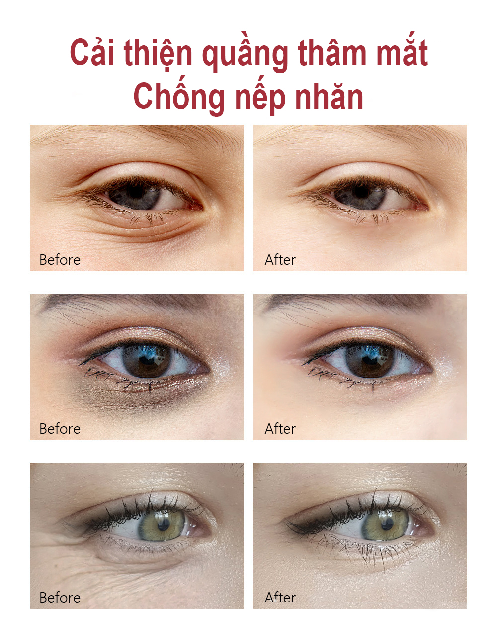 vibrant glamour kem mắt vg retinol giảm quầng thâm mắt bọng mắt dưỡng ẩm chống nếp nhăn moisturizing anti-aging eye cream retion 4
