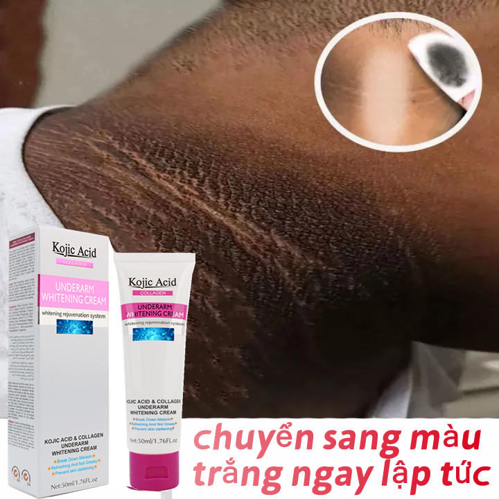 Kem giảm thâm làm trắng vùng nách，khử mùi hôi vùng nách，làm trắng vùng kín,đầu gối,khuỷu tay chân