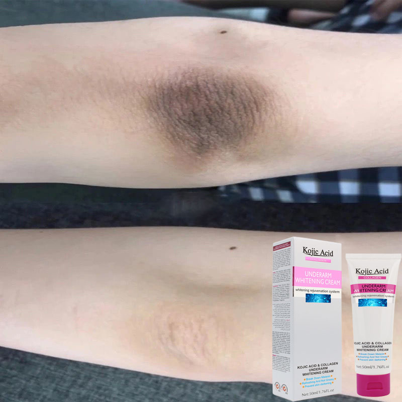 Trị thâm mông kem trị thâm làm trắng vùng nách,khử mùi hôi vùng nách,trị thbody cấp Whitening Underarm Moisturizing Lotion Body Cream. Làm trắng và khử mùi hôi nách, trị thâm nách, thâm đầu gối, khuỷu tay.