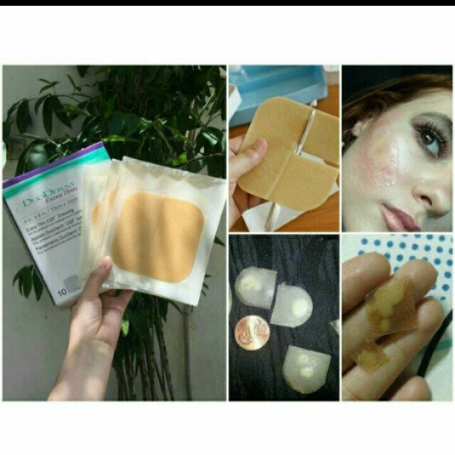Miếng dán mụn/vết thương hở Duoderm Extrathin 5x20, 10*10 cm