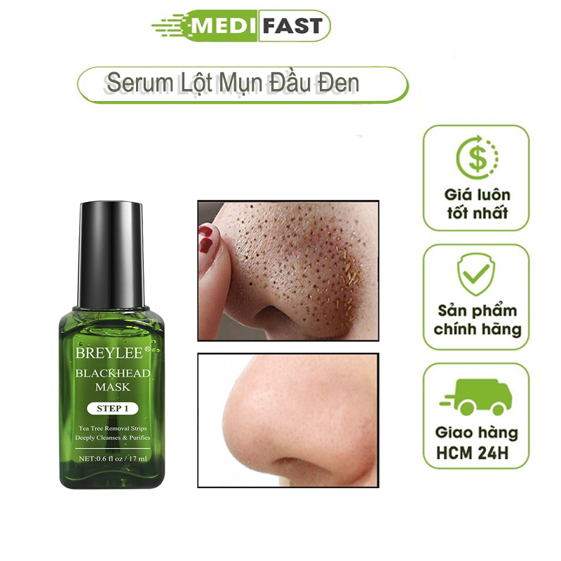 Serum Lột Mụn Đầu Đen Ngăn Ngừa Mụn Cám Làm Sạch Da Loại Bỏ Mụn Trứng Cá Chăm Sóc Da FACIAL MASK SKIN CARE BLACKHEAD REMOVER SERUM 30ml