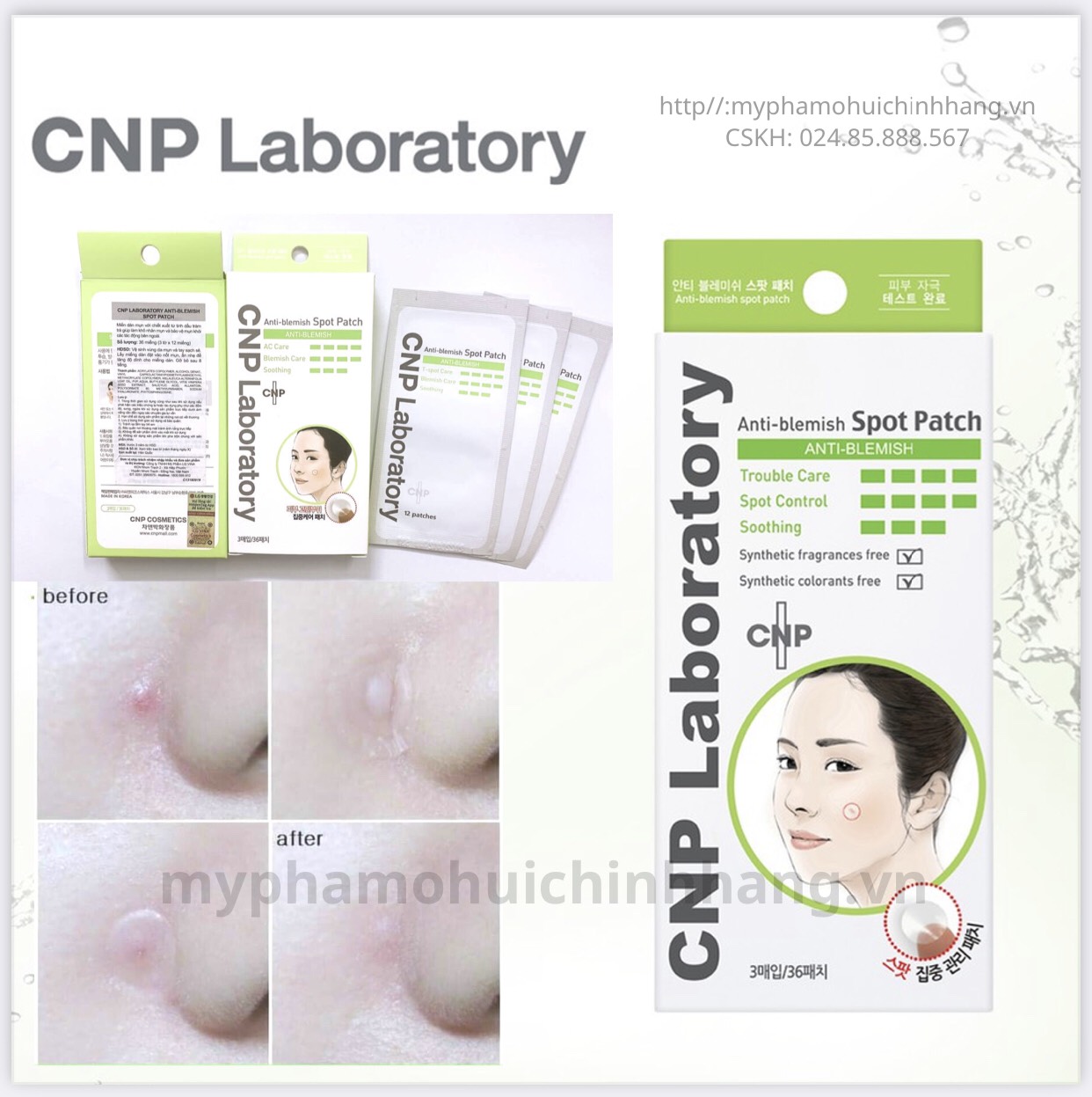 Hộp 36 miếng dán mụn trong suốt cnp laboratory anti-blemish spot patch hàn quốc hàng nhập khẩu chính hãng