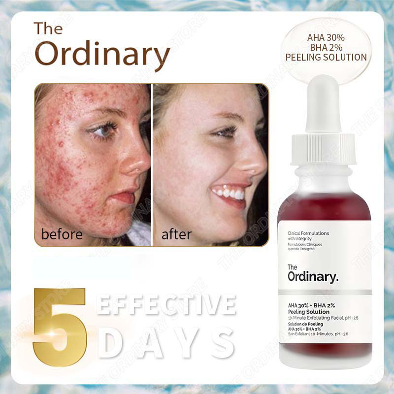 The Ordinary Serum AHA 30% + BHA 2% Tẩy da The Ordinary serum tẩy tế bào chết da mặt chính hãng chết