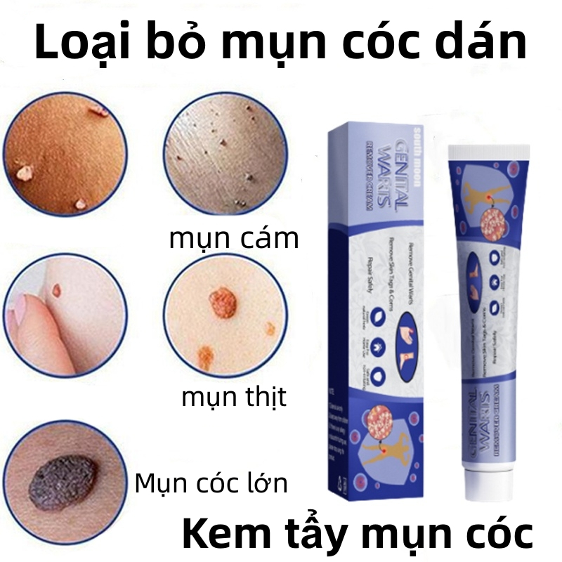 Kem tẩy nốt ruồi trị mụn cóc kem mụn cóc 7 ngày loại bỏ mụn cóc nhanh chóng Loại bỏ mụn cóc an toàn và không đau 20ml
