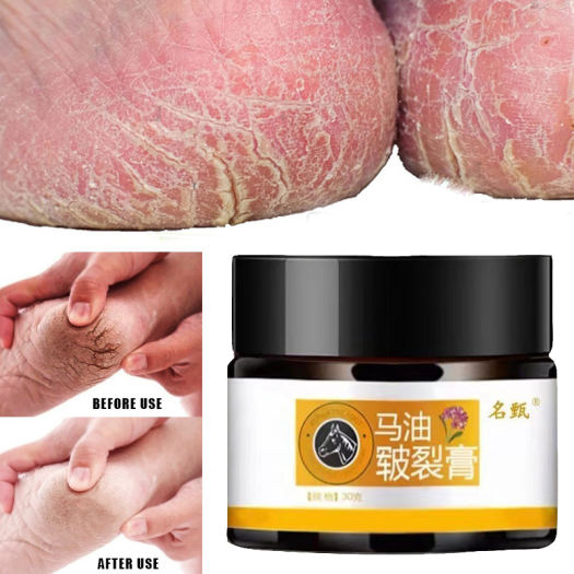 [BÁN SỈ] KEM NGỰA THÀNH PHẦN TỰ NHIÊN HẾT SẠCH NỨT NẺ CHÂN TAY, LOẠI BỎ TẾ BÀO CHẾT NHANH CHÓNG HẾT TRONG VÀI NGÀY