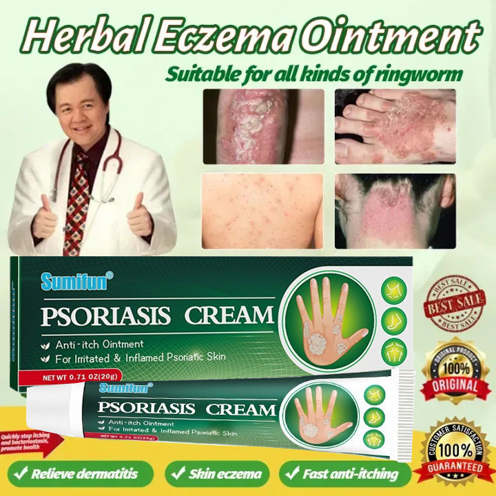 Kem giảm ngứa và chăm sóc da Mỡ nấm chân bị nấm mát lạnh Herbal Itching cream