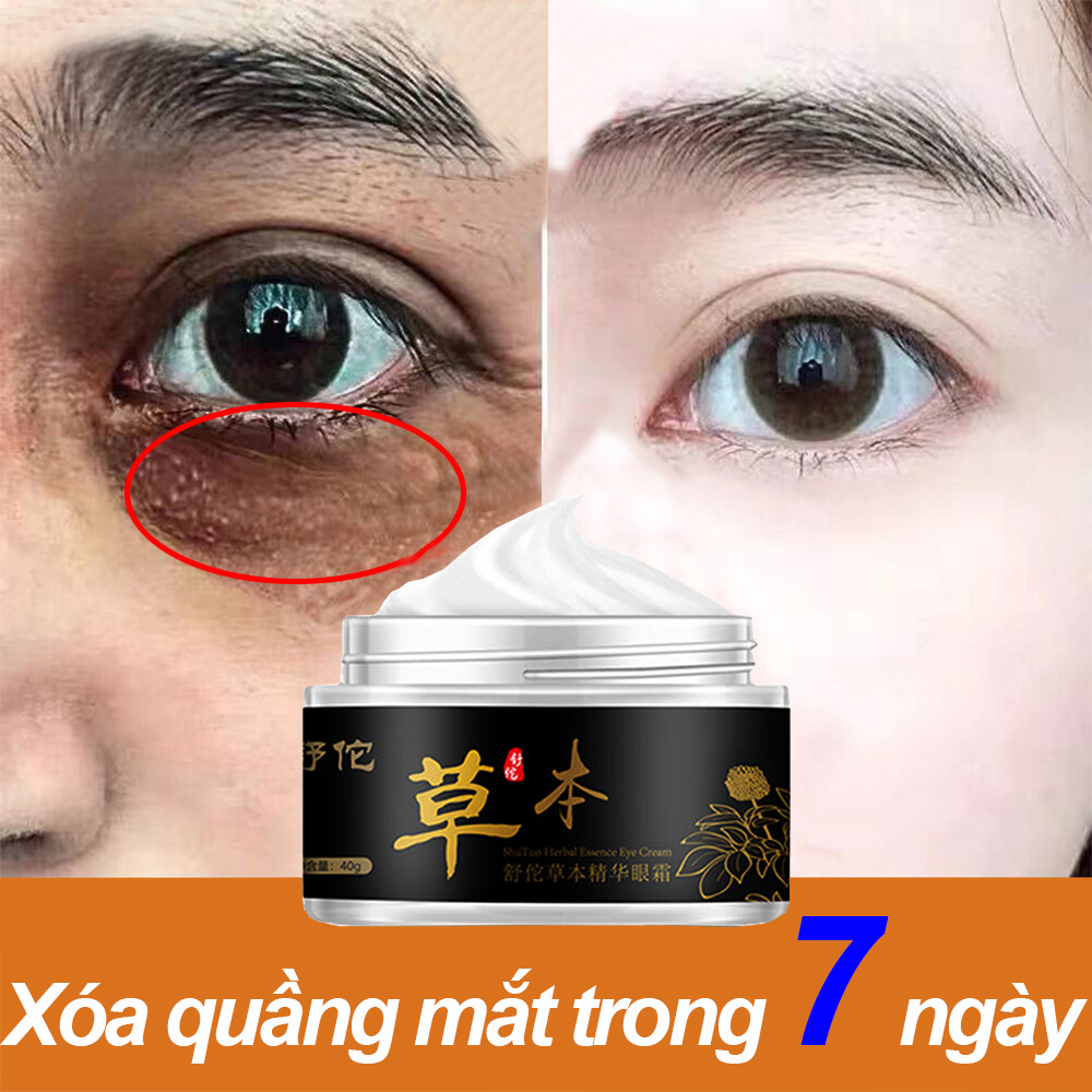 Xóa thâm quầng mắt và tinh chất chống lão hóa mắt Kem dưỡng mắt chống nhăn 40g làm trắng và dưỡng ẩm, loại bỏ các hạt mỡ tích tụ quanh mắt, làm săn chắc vùng da quanh mắt và đẹp mắt