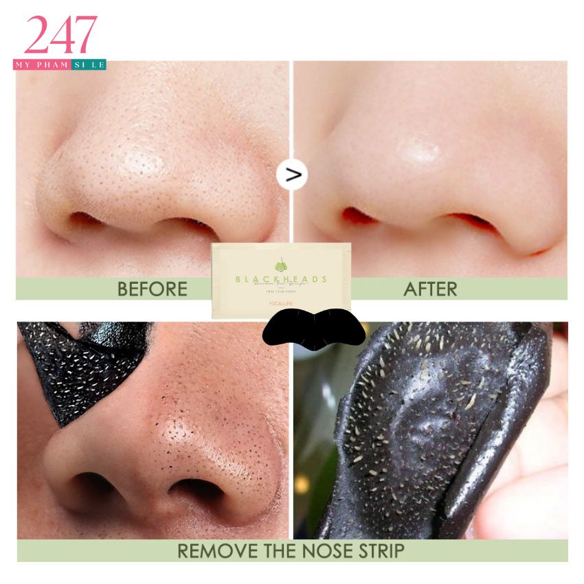 Miếng lột mụn đầu đen ở mũi Focallure miếng lột mụn mũi Myphamsile247 Foc125