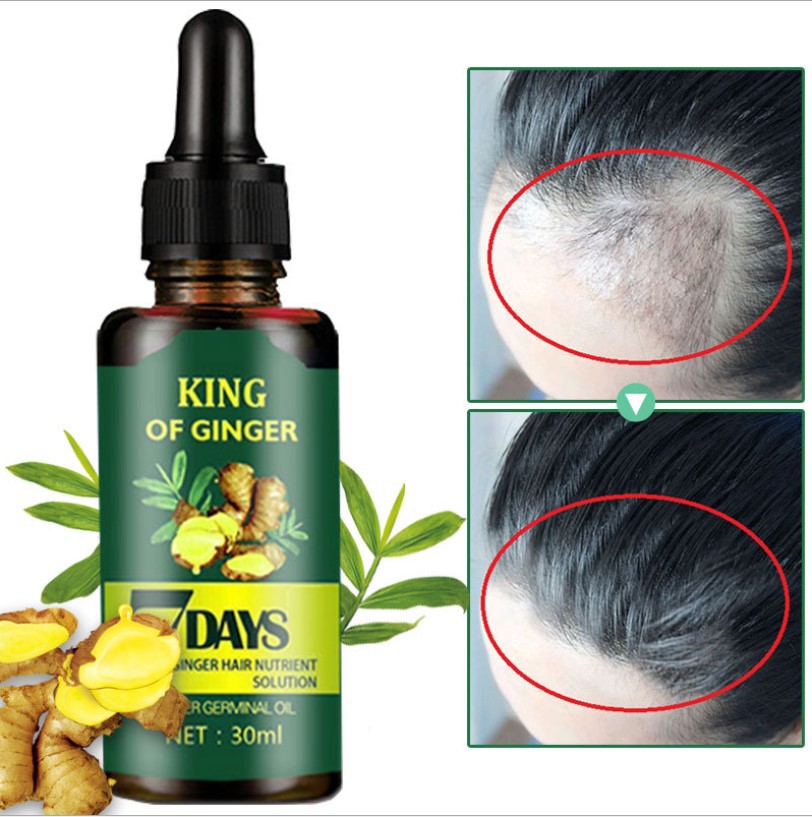 ( CHÍNH HÃNG ANH)  tinh chất mọc tóc chỉ sau 7 ngày cho tất cả ai bị hói đầu, bị rụng tóc do tuổi tác, do sau sinh đẻ....