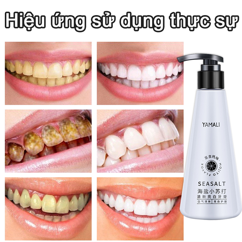 Kem đánh răng kem đánh răng trắng răng kem đánh răng baking soda 85g Làm sáng bằng vôi Chống Sâu Răng, Loại Bỏ Vết Ố Răng Do Hút Thuốc, Chống Chảy Máu Chân Răng Và Lở Loét Miệng, Làm Trắng Nhanh, Khử Mùi Hôi Miệng