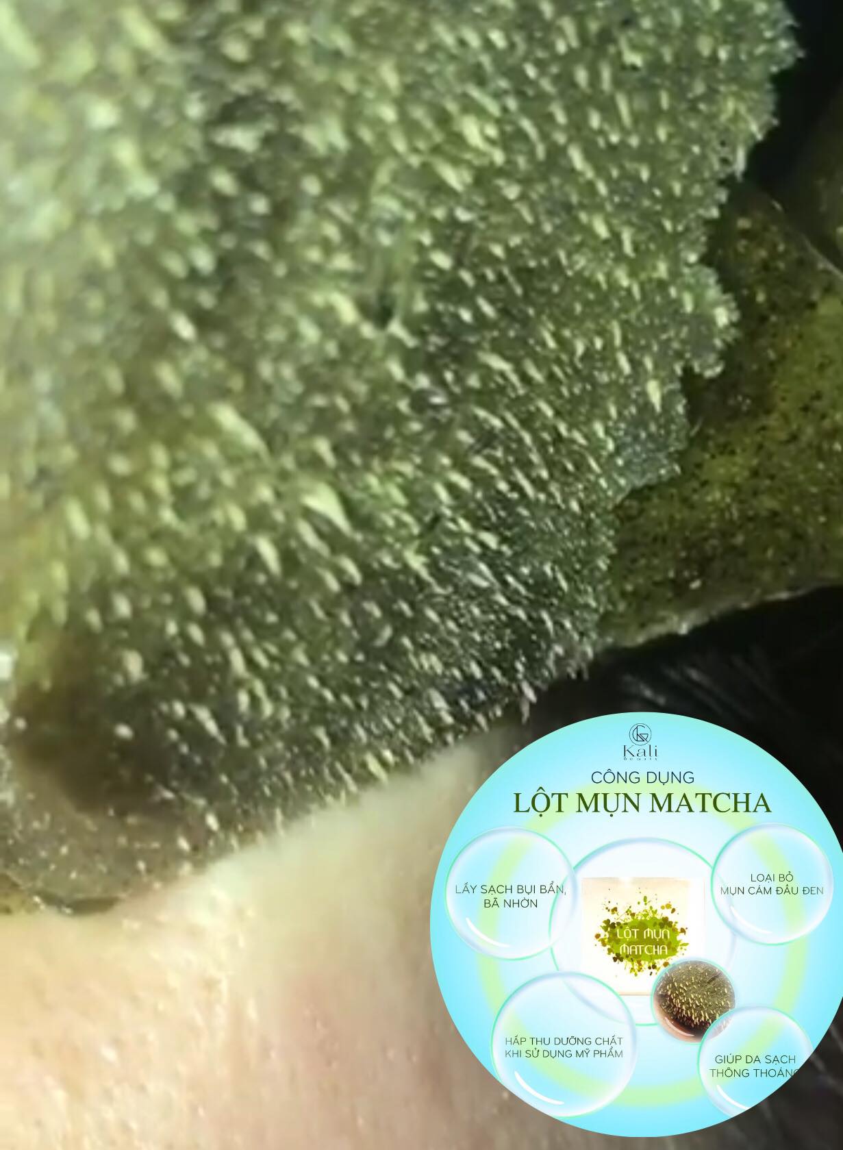 combo 5 hủ bột lột mụn chiết xuất từ lá trà xanh - giúp da sạch, khỏe, mịn màn