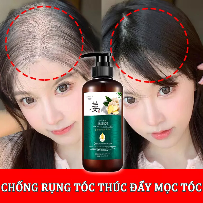 Dầu gội thảo dược chống rụng tóc Kích thích mọc tóc và ngăn ngừa rụng tóc,dày tóc, dưỡng tóc, chắc chân tóc, mềm mại suôn mượt, dùng cho nam và nữ