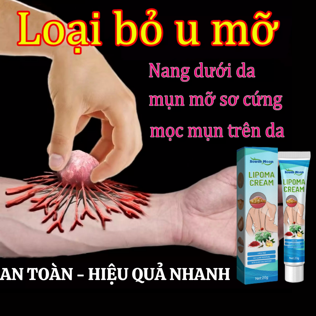 [Hoàn Tiền 20%] South Moon Kem Loại Bỏ Lipoma Lipolysis Kem tan u mỡ loại bỏ u mỡ hiệu quả kem loại 