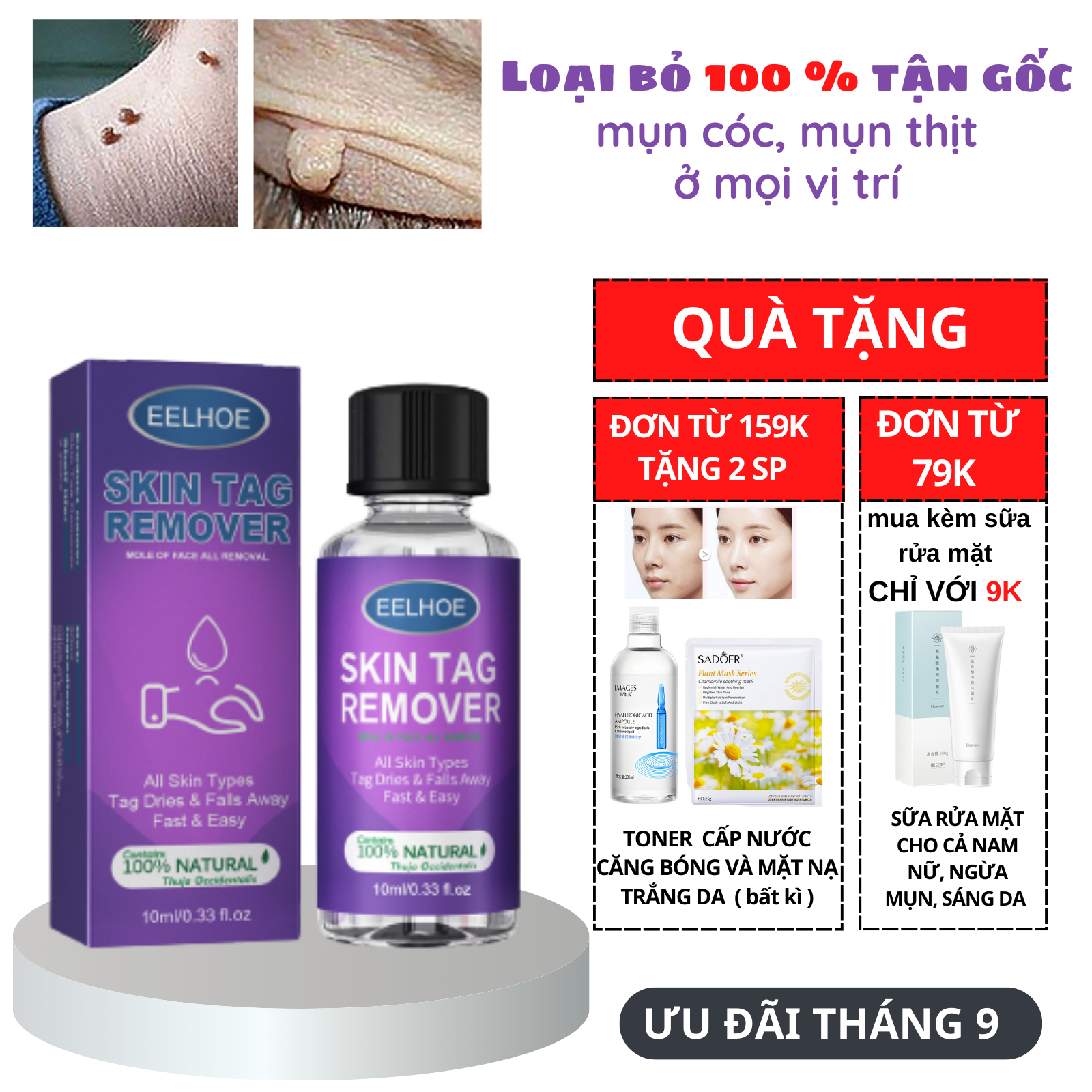 Tinh chất skin tags bôi rụng hết sạch mụn thịt thừa mụn cóc mụn nốt ruồi hiệu quả tận gốc 10ml