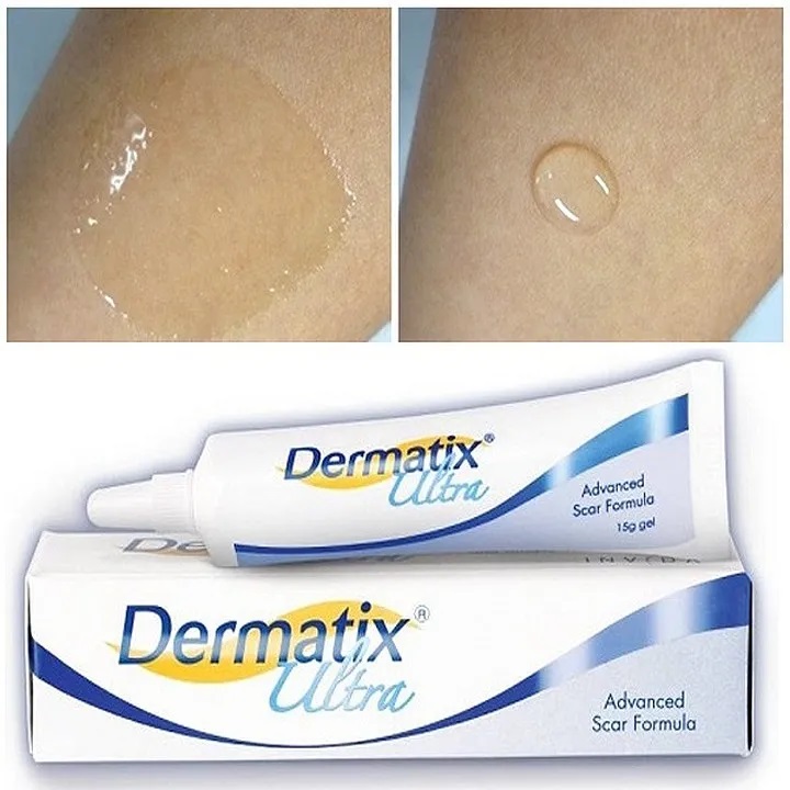 Kem Dermatix Ultra Hỗ Trợ Làm Phẳng Các Vết Sẹo Lồi, Lõm, Thâm Và Rỗ Lâu Năm, Giảm Cảm Giác Ngứa Ngáy Khó Chịu