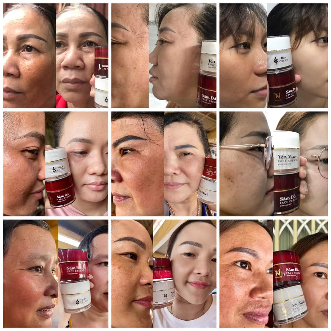 Combo kem face yến mạch và sâm đỏ naturally dành cho da nám và dưỡng trắng da