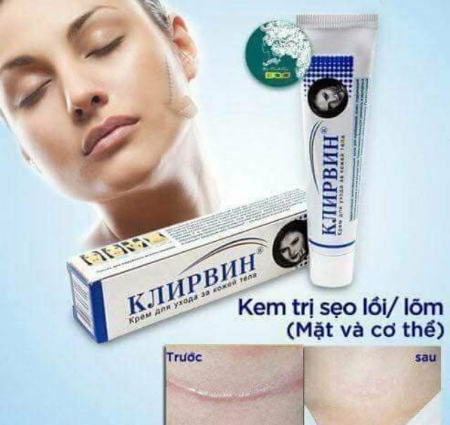 Kem mờ sẹo lồi, lõm, sẹo thâm chỉ trong 2 tháng Klirvin