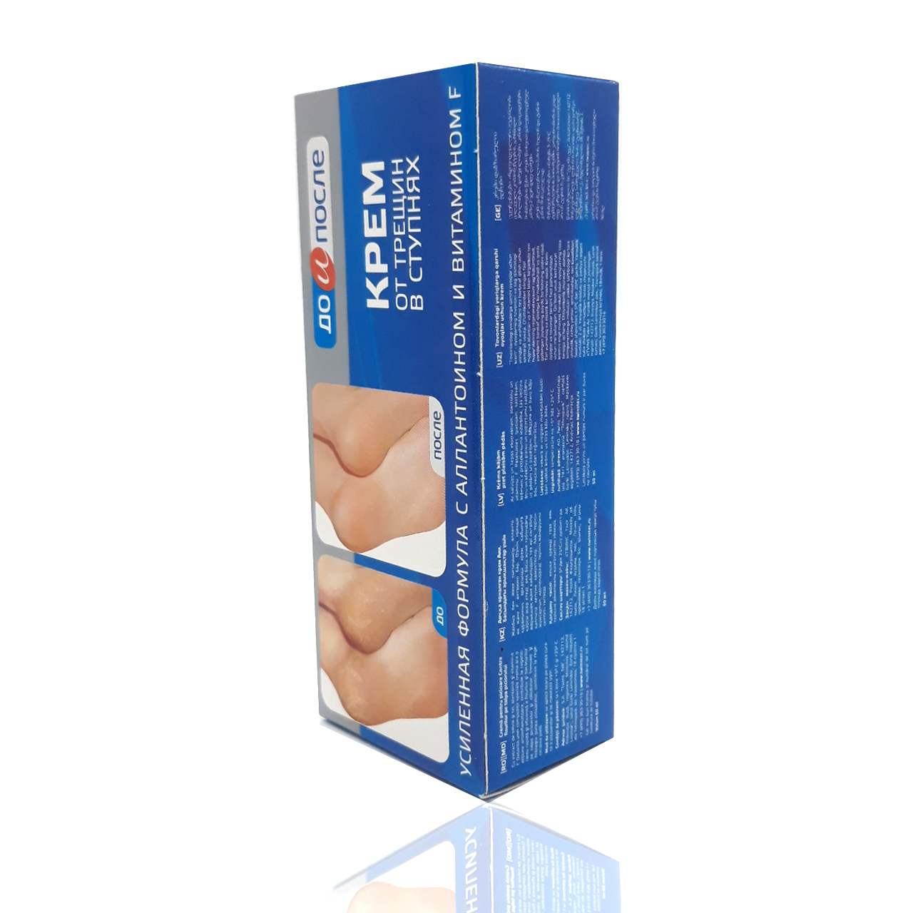 Kem nứt gót chân kpem nga 50ml