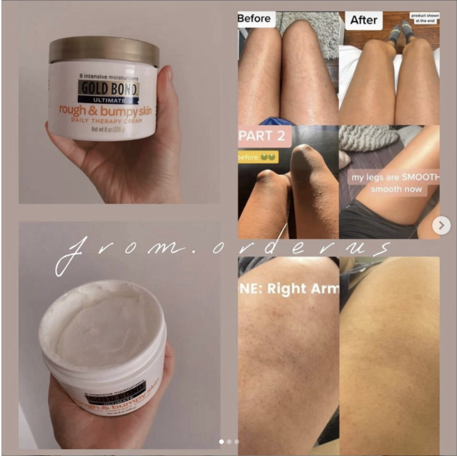 Kem dưỡng da gold bond ultimate rough & bumpy skin