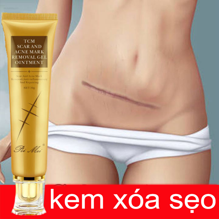 Kem phục hồi sẹo, chăm sóc sẹo, giảm sẹo mụn, phục hồi sẹo, làm sáng sẹo,