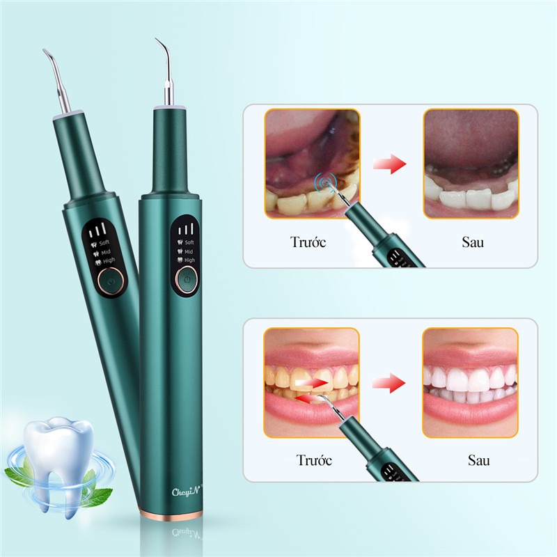 máy lấy cao răng tại nhà ckeyin với 3 chế độ điều chỉnh và 3 đầu thay thế tiện lợi khi vệ sinh răng miệng kq140l 5