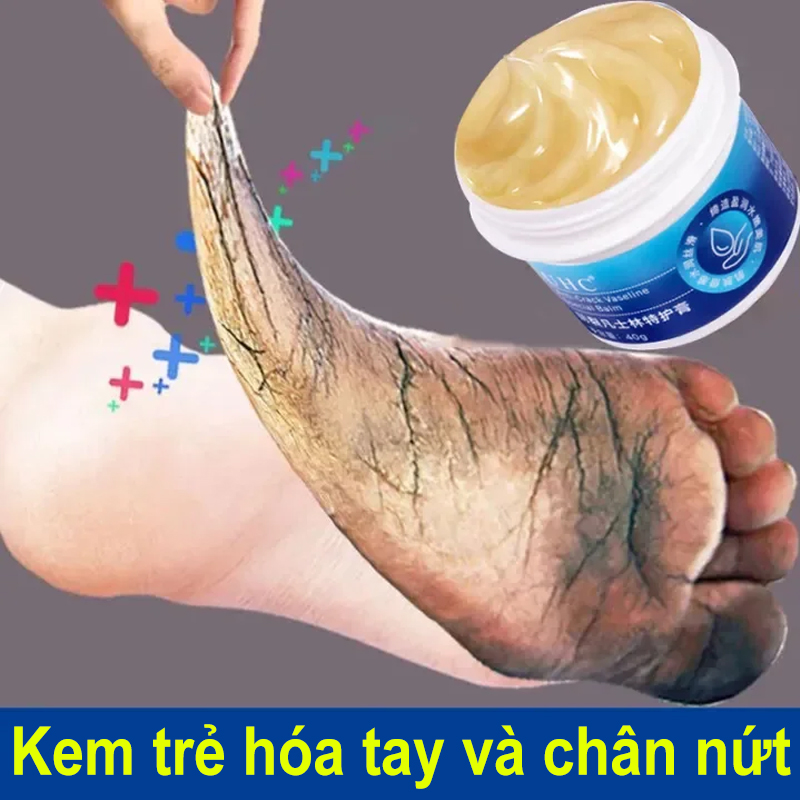 Kem Giảm Nứt Gót Chân Vaseline 40gr Kem dầu ngựa dưỡng da chân chống nứt nẻ và thô ráp mềm da chân Ngựa nứt gót sừng hóa tay Giảm Nứt Nẻ Chân Tay Dưỡng Ẩm Mạnh Mẽ,Kem bôi nứt nẻ gót chân cao ngựa,kem cao ngựa trị nứt gót chân lẻ toàn thân