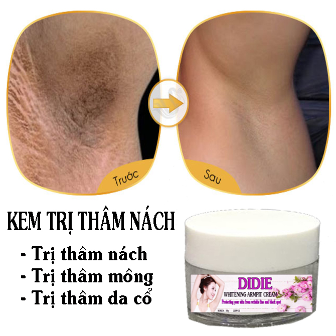 [HCM]Kem Dưỡng Trắng Nách Xóa Thâm Mịn Da DIDIE